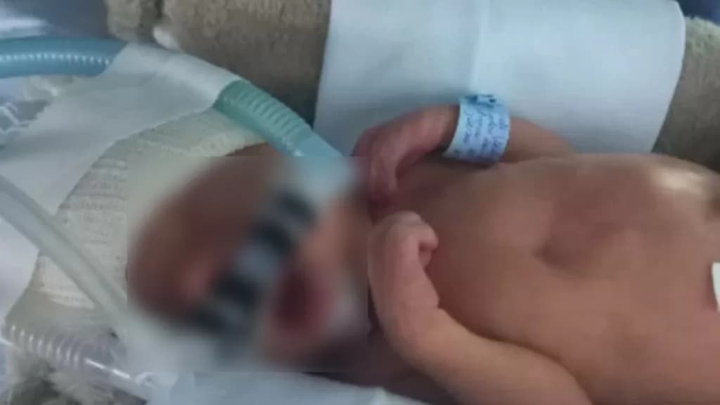 Bebê tem doença rara em PG e família pede ajuda para pagar tratamento