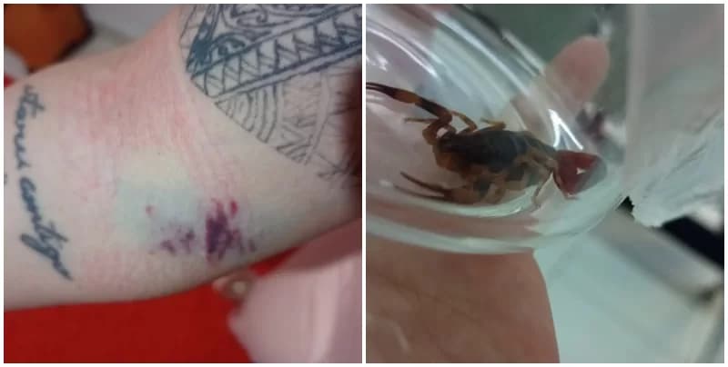 Mulher é picada por escorpião em bairro de Ponta Grossa e sofre problemas cardíacos
