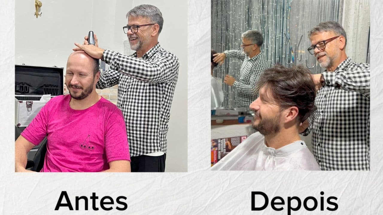 Prótese capilar rejuvenesce e traz autoconfiança. Confira o depoimento