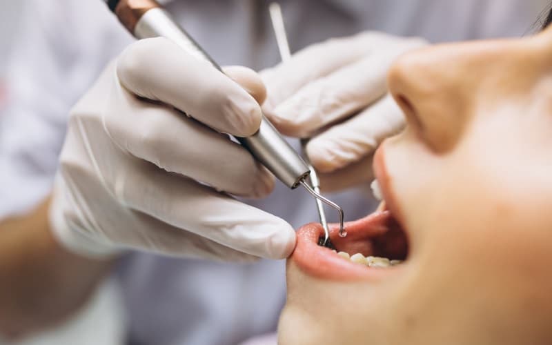 Curso de especialização seleciona pacientes para procedimentos odontológicos em PG