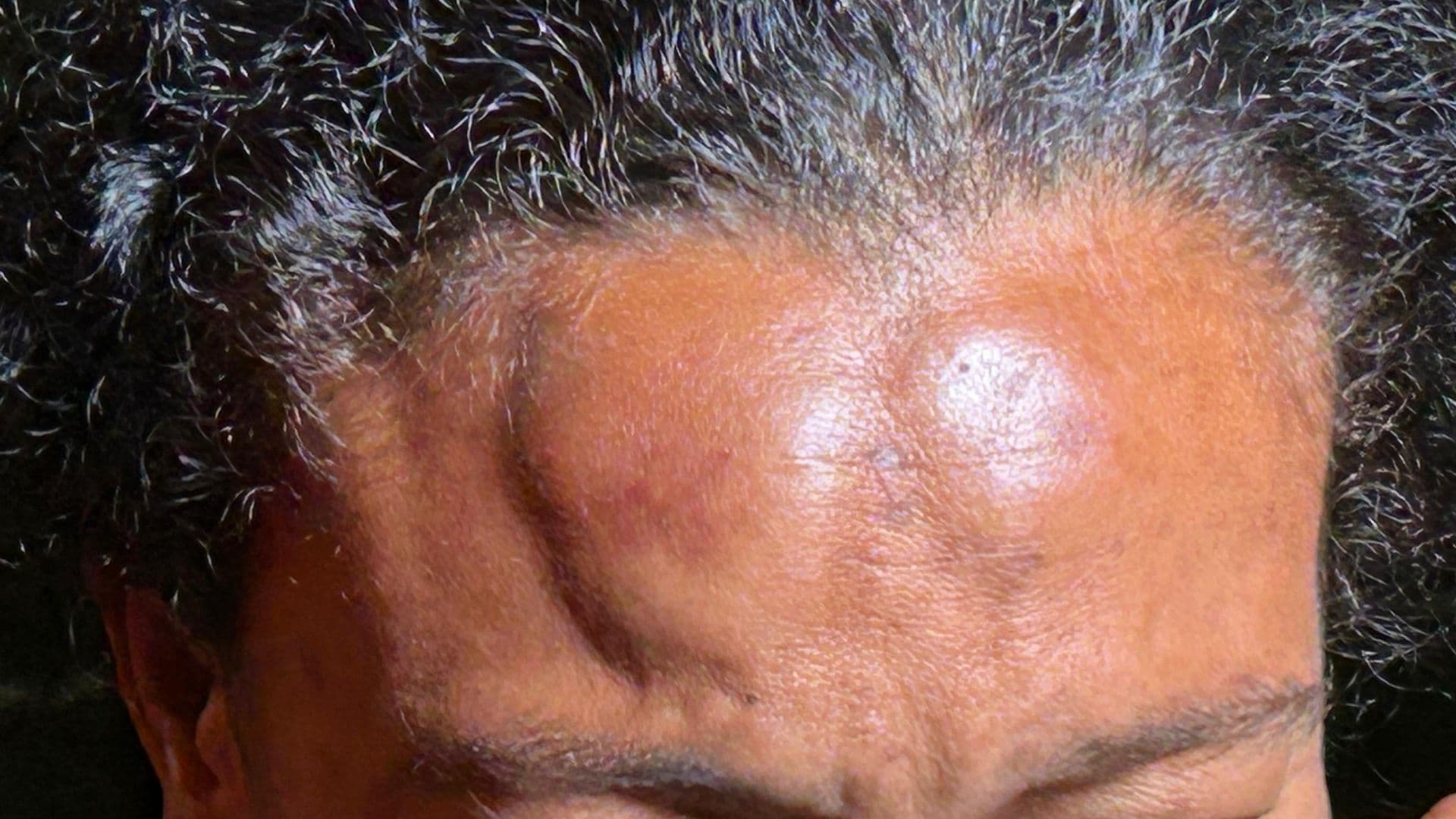 Foto da mulher que foi brutalmente agredida pelo marido antes de ter casa queimada, em PG