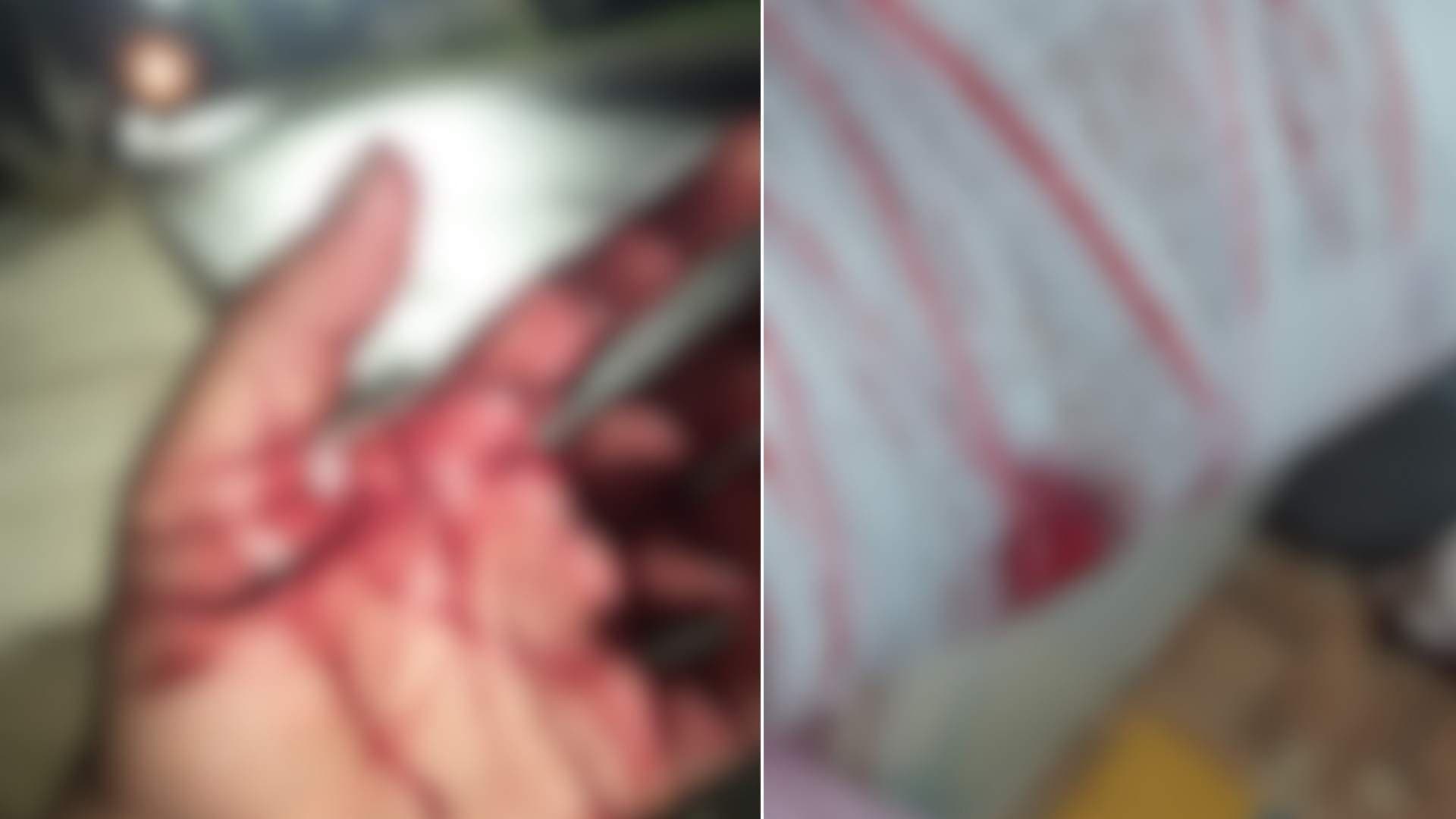 Vizinho tentou matar mãe e filha à facãozada em PG, dizem vítimas
