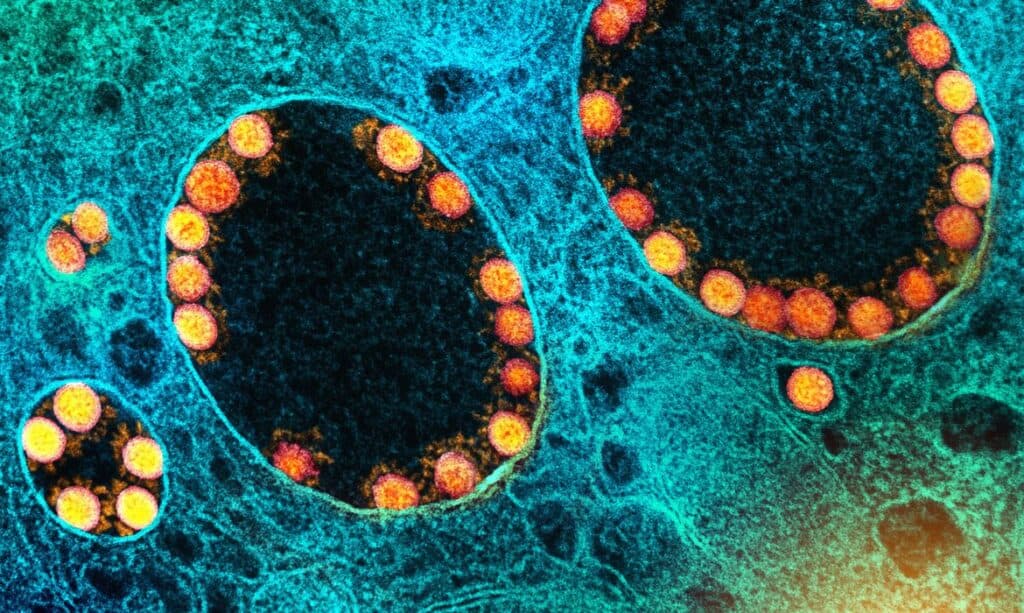 Variante Ômicron é detectada em crianças na Africa
