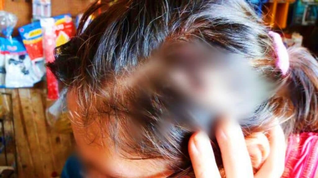 Mulher é agredida com coronhadas na cabeça e marido acaba preso