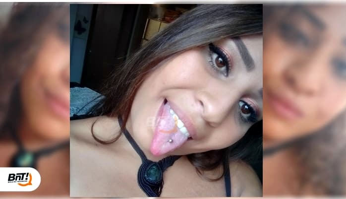 Morre jovem que teve 70% do corpo queimado em PG