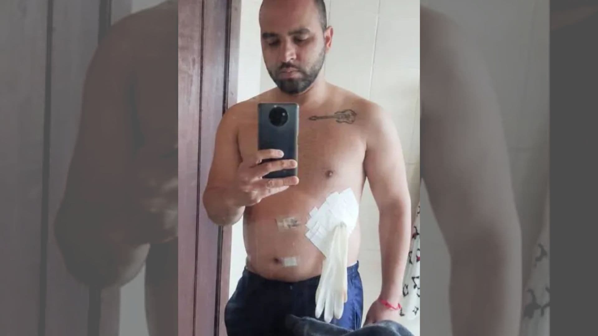 Paciente tem luva colocada no lugar da bolsa de colostomia no PR