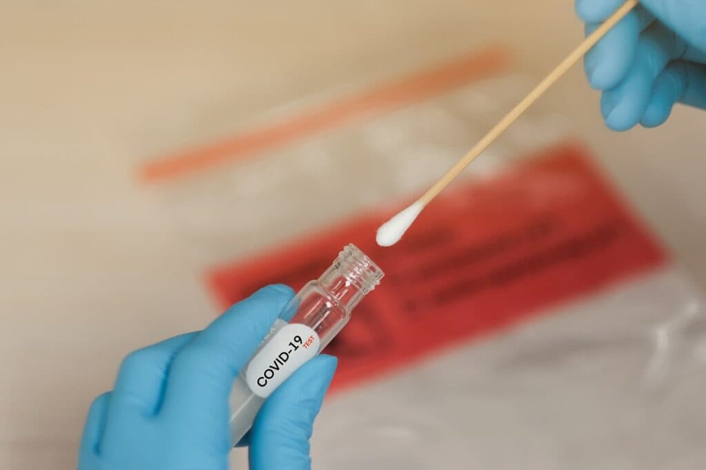 Procon PG orienta sobre aumentos de preços de testes de Covid e Influenza