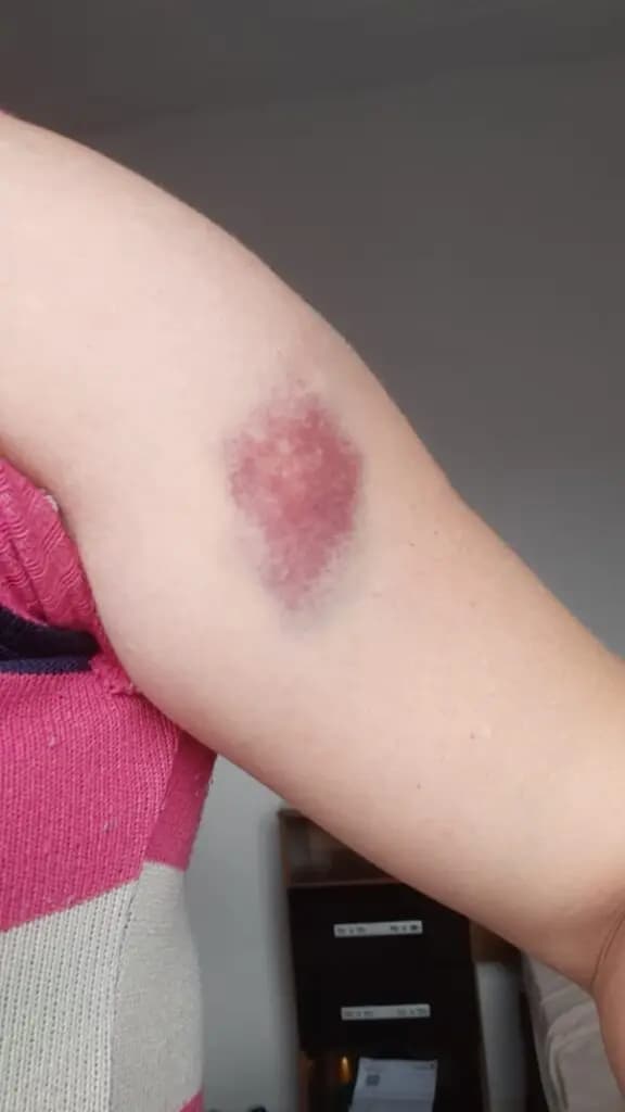 Enfermeira é agredida por paciente embriagado na UPA Santana