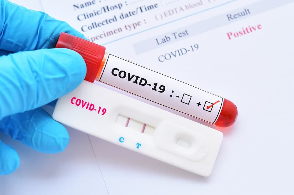 PG registra 312 novos casos de COVID!