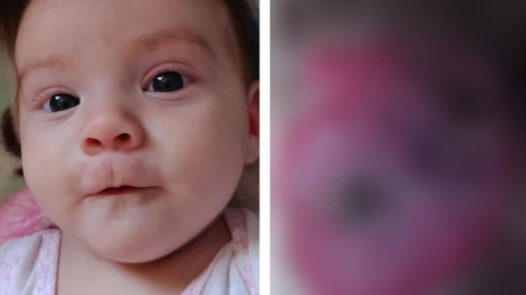 Família pede ajuda para pagar tratamento de bebê