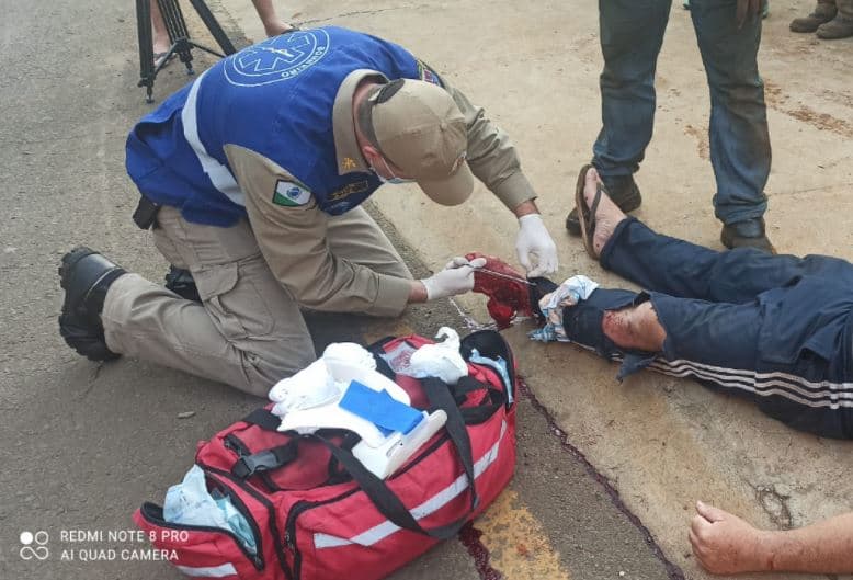 ACIDENTE GRAVE DE MOTO