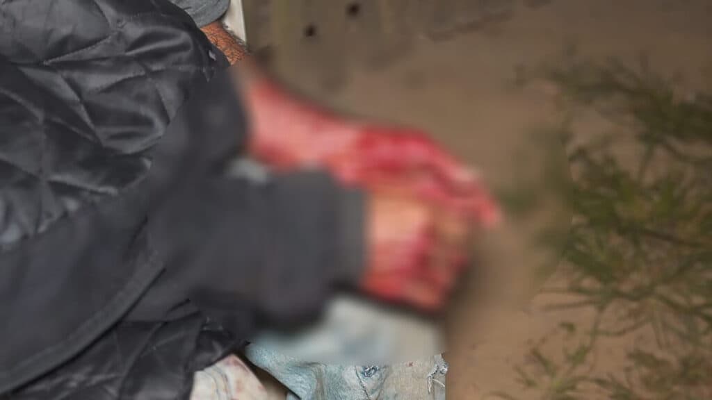 Novo ataque de pitbull deixa homem ferido em bairro de PG