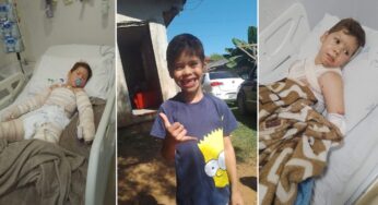 Família pede ajuda com vaquinha para acompanhar tratamento de criança com queimaduras graves