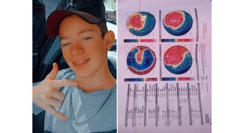 Jovem com doença nos olhos pede ajuda para realizar cirurgia em PG
