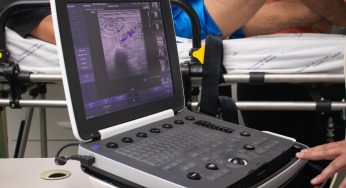 Mutirão de exames de Doppler arterial identifica doenças em pacientes de Tibagi