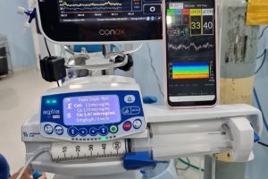 Chega ao Brasil novo aparelho de monitoramento de anestesia