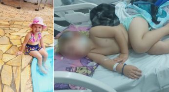 Criança com suspeita de dengue consegue transferência para o HUMAI após aguardar na UPA Santa Paula