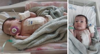 Bebê aguarda há 10 dias no HUMAI por leito em hospital de referência cardíaca pediátrica no PR