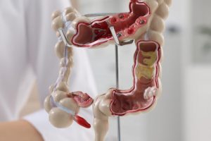 Adrian Bester lança curso on-line de modulação intestinal