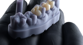 FGM Dental Group e dOne 3D apresentam a Voxelprint Ceramic