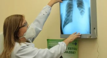 Brasil está na contramão da meta da OMS para extinção da tuberculose