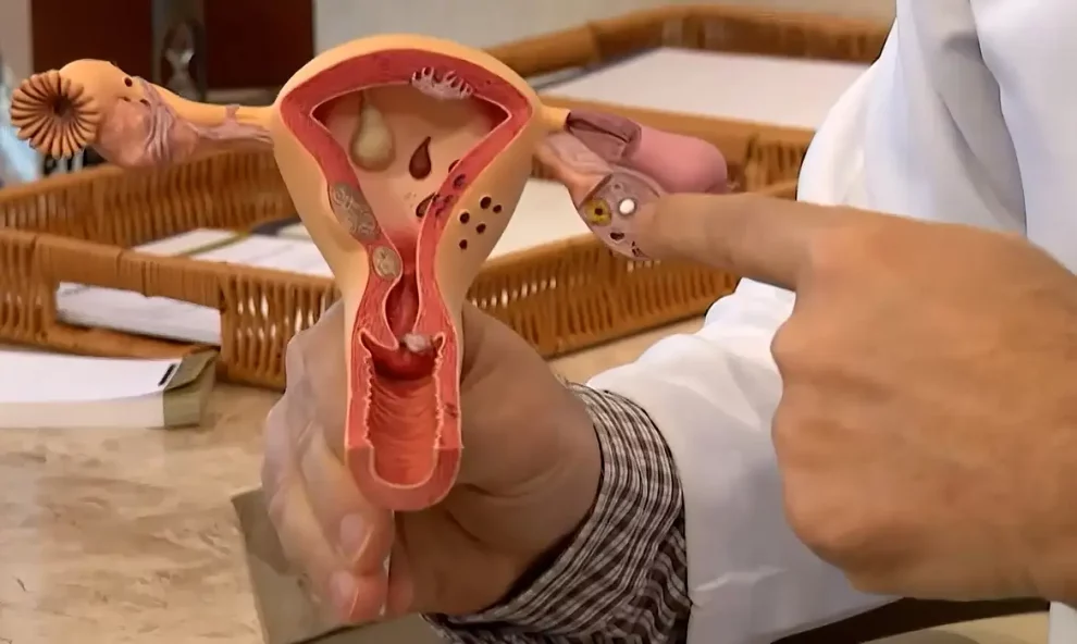 Exame ginecológico é o primeiro passo para a identificação da endometriose Boca no Trombone Exame ginecológico é o primeiro passo para a identificação da endometriose