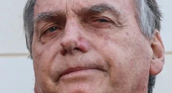 Ex-Presidente Jair Bolsonaro apresenta piora clínica após cirurgia