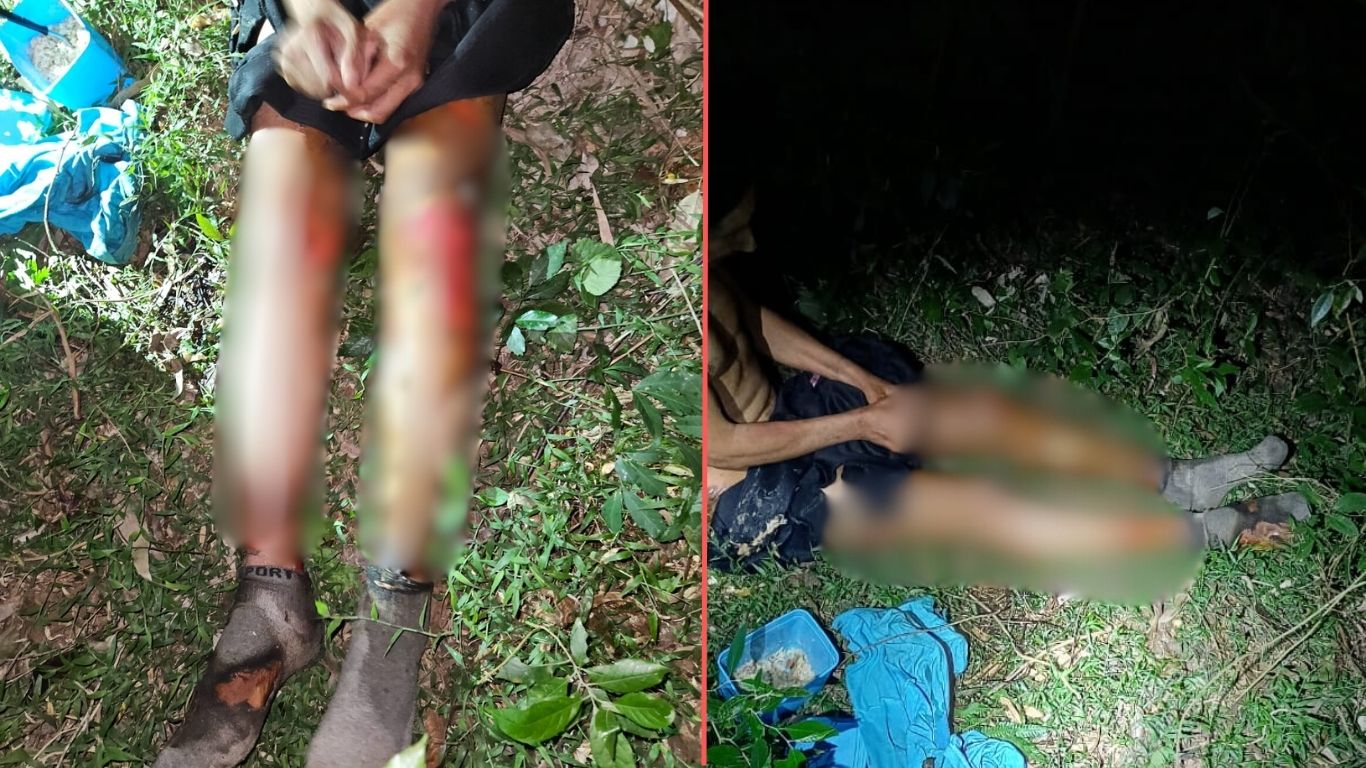 Homem sofre queimaduras graves em Guaragi, distrito de Ponta Grossa